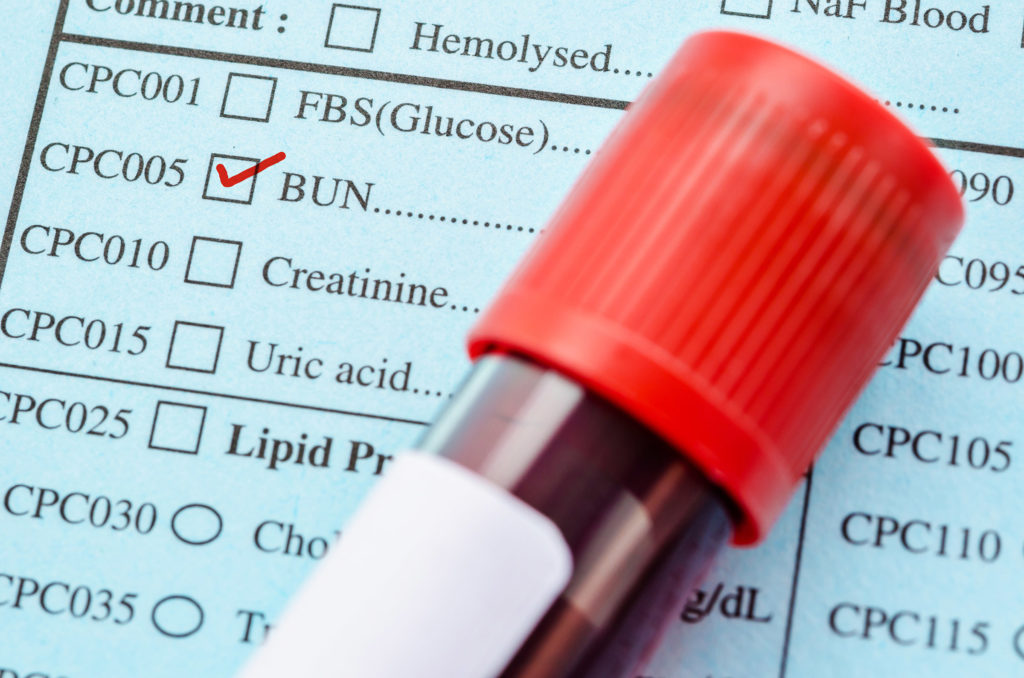 Bloodwork + Routine Lab Tests in Denver, CO YAO Clinic