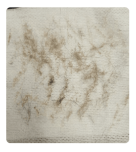 Plain Jane? Not a Chance with Denver Dermaplane Services to Brighten & Tighten Skin plainJaneFuzz 269x300 - Plain Jane? Not a Chance with Denver Dermaplane Services to Brighten & Tighten Skin